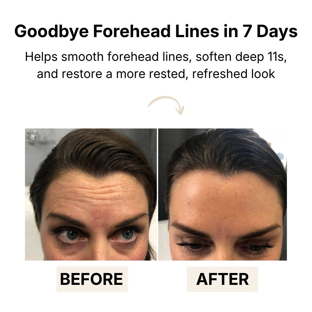 Balvix Anti-Wrinkle Patch